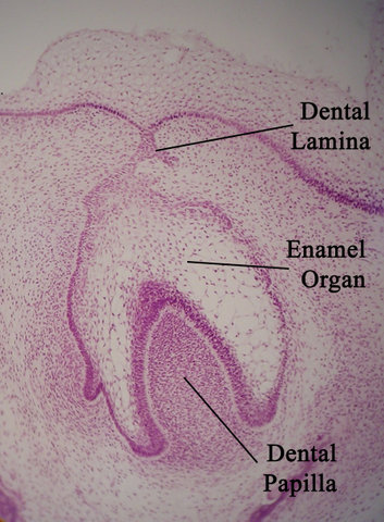 Image:Toothhistology11-17-05.jpg