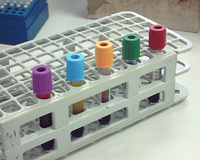 A range of Vacutainer tubes containing blood.