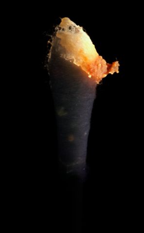 Image:Earwax on swab (uv).jpg