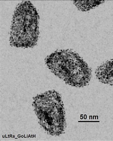Image:Elec micro of rahbdovirus isolate.jpg