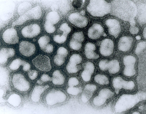Image:Influenza A - late passage.jpg