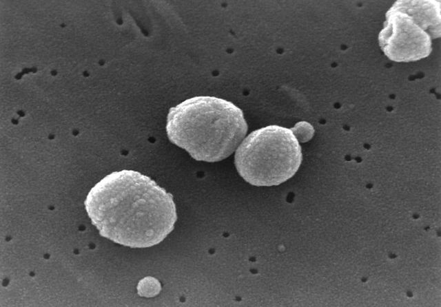 Image:Streptococcus pneumoniae.jpg