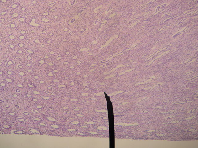 Image:Kidney-medulla.JPG