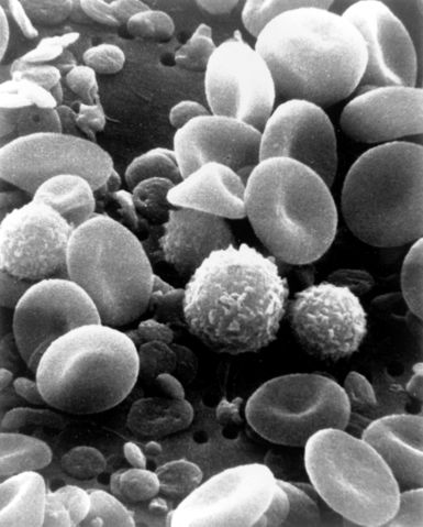 Image:SEM blood cells.jpg