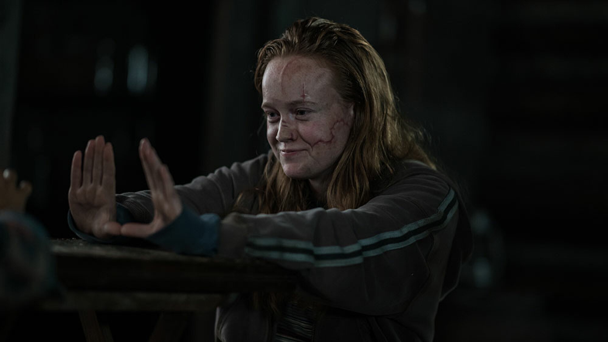 A red-haired teenage girl with scars on her face holds her hands out in front of her and smiles