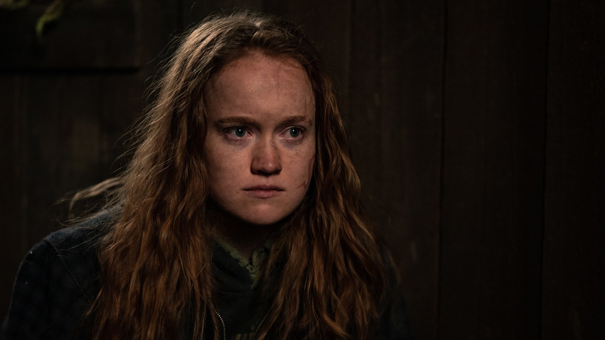 A young woman with a scarred face.