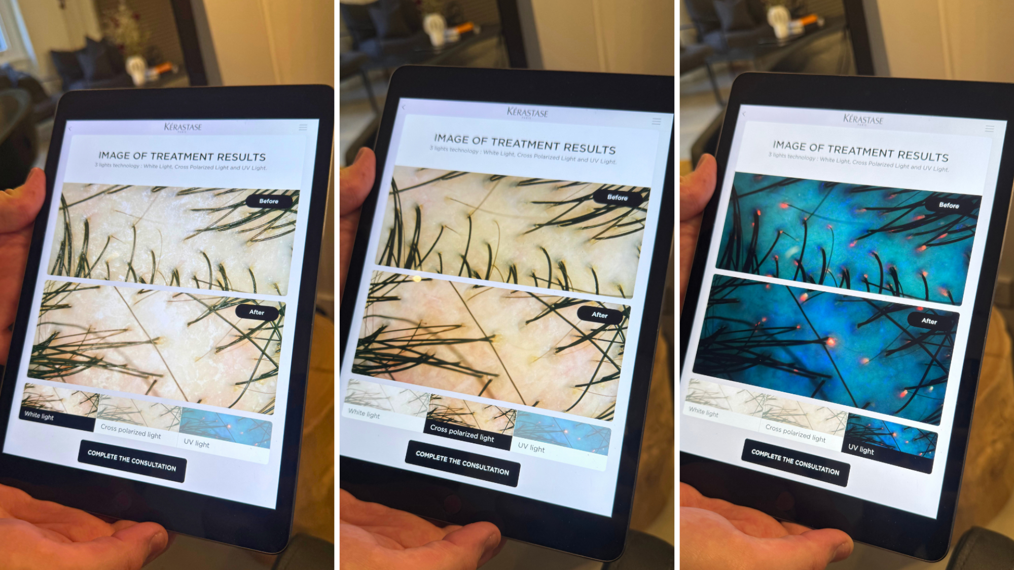 Three photos of K-SCAN results on a tablet, showing before and after results after a hair treatment under white light, cross polarised light, and UV light.