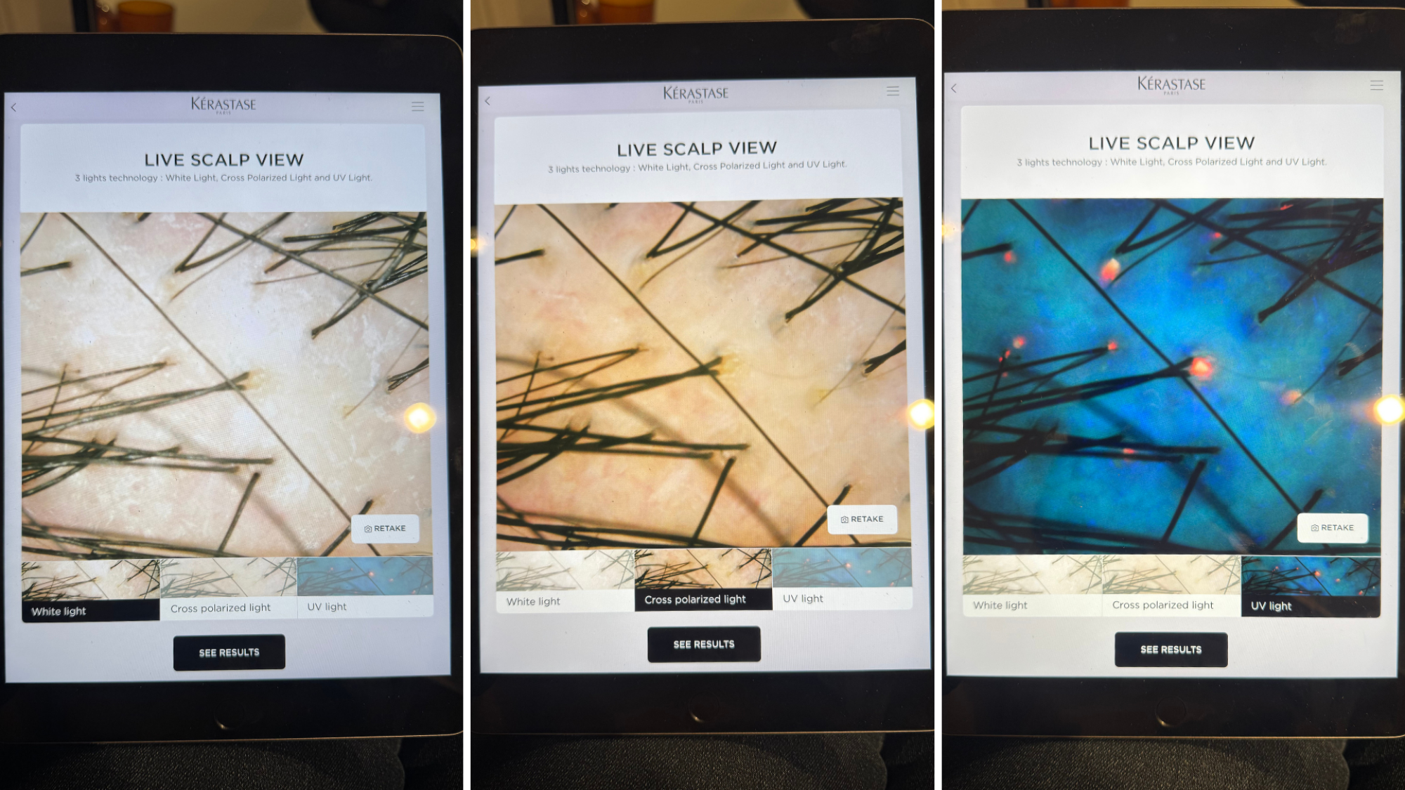 Three photos of K-SCAN results on a tablet, showing a live scalp view under white light, cross polarised light, and UV light.